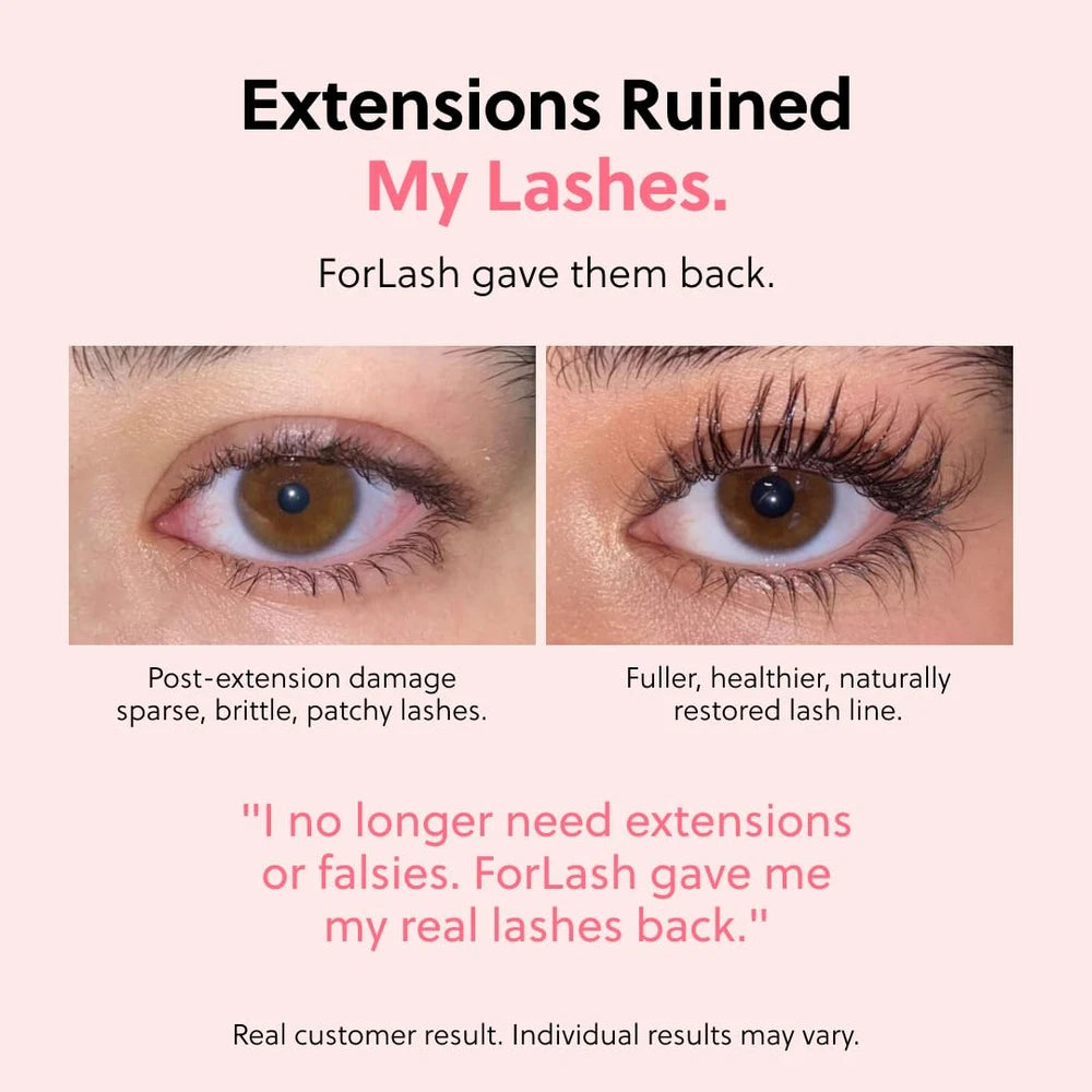 ForChics Eyelash Growth Serum